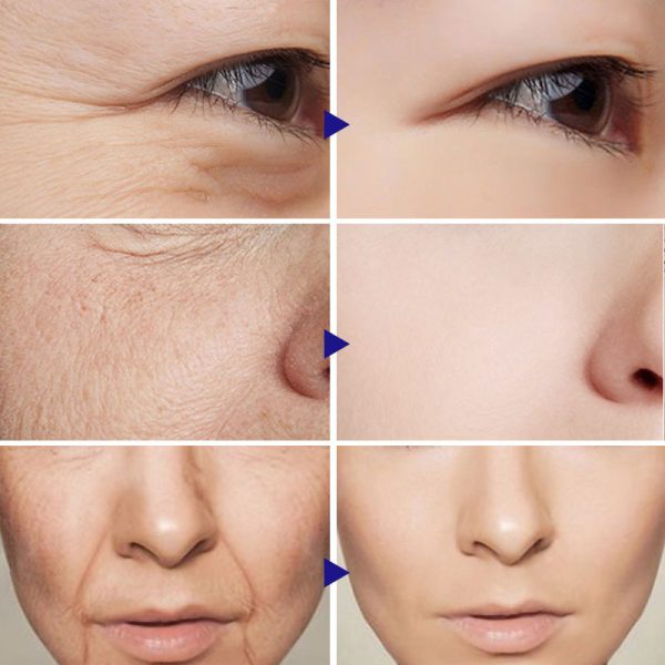 Vitamin C Facial Serum Amazon: Brighten - Image 5